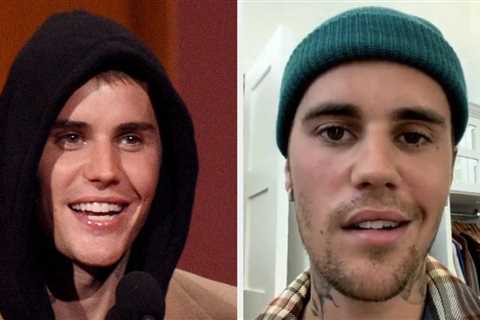 Justin Bieber Shared A Video Of Himself Moving Both Sides Of His Face For The First Time Since He..