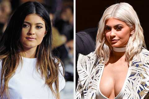 Kylie Jenner Just Casually Confirmed The Years-Long Speculation That She Had A Secret Boob Job As A ..