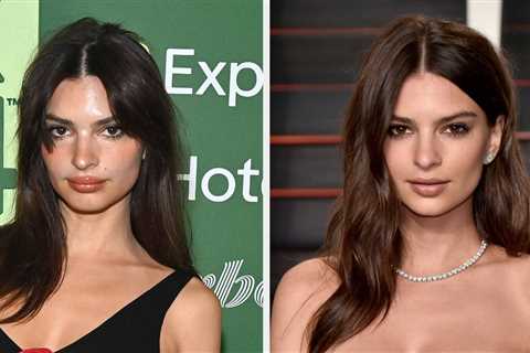 Emily Ratajkowski Spoke About Getting Botox: My Face Still Moves, Which I Am Quite Proud Of