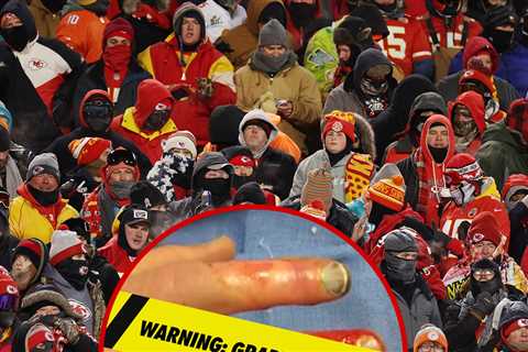 Chiefs Fans Reportedly Getting Frostbite Amputations From NFL Playoff Game