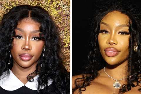 SZA Revealed That She Got Breast Implants And Had Them Taken Out Because Of Fibrosis