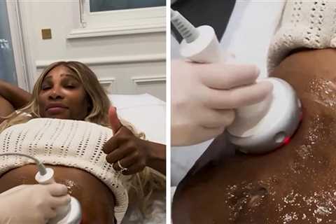 Serena Williams Gets Tummy-Tightening Procedure For Pre-Kids Confidence