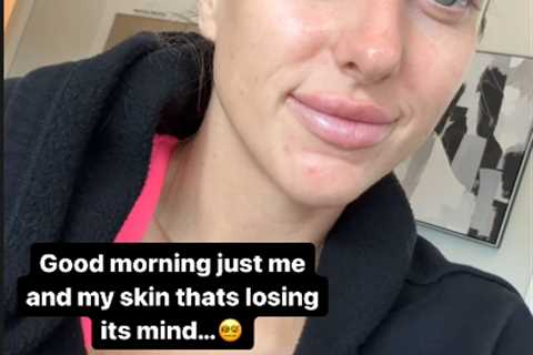 Brittany Mahomes opens up about third pregnancy being ‘the hardest’ on her