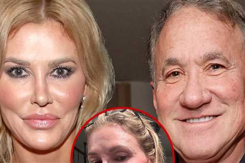 Brandi Glanville Tells Fans Her Face Fillers Are Dissolved, Connects With Terry Dubrow
