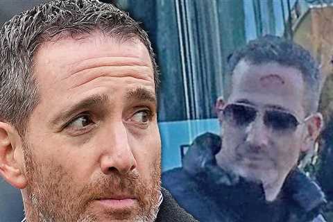 Eagles GM Howie Roseman Bloodied At Super Bowl Parade After Beer Can Mishap