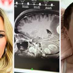 “Real Housewives” Star Teddi Mellencamp Reveals She's Been Diagnosed With More Brain Tumors And Is..