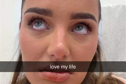 Love Island Star's Emergency in LA
