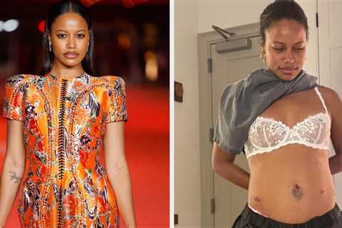The Pain Would Make Me See Stars: Taylour Paige Opened Up About Her Silent Battle With Endometriosis