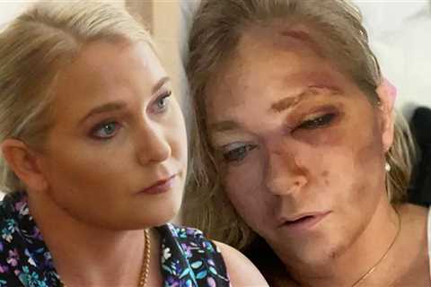 Virginia Giuffre's Accident Story Is Allegedly Full Of Holes, Called Out As a Liar