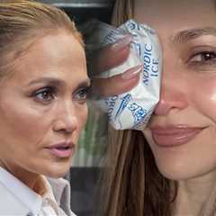 Jennifer Lopez Gets Stitches After Injuring Herself at AMAs Rehearsals
