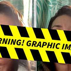 Evangeline Lilly Reveals Gruesome Facial Injury After Fainting on Beach