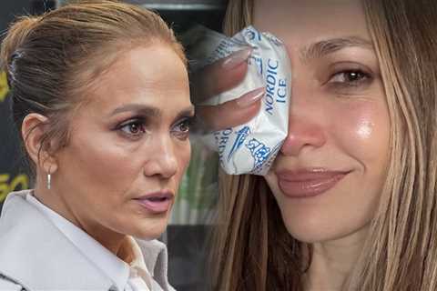 Jennifer Lopez Gets Stitches After Injuring Herself at AMAs Rehearsals