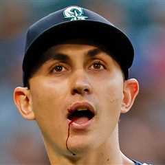 MLB Star George Kirby Hit In Mouth By 102.7 MPH Line Drive, Leaves Game Bloodied