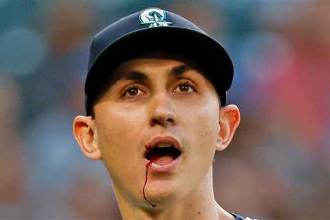 MLB Star George Kirby Hit In Mouth By 102.7 MPH Line Drive, Leaves Game Bloodied