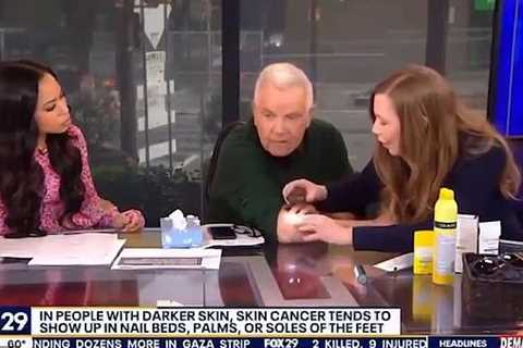 Unforeseen Discovery: TV Host Confronts Skin Cancer Diagnosis Live