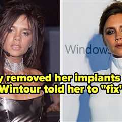 34 Celebrities Who Reversed Their Cosmetic Surgery