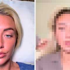 This Love Island Star Just Got Fox Eye Surgery, And The Results Are Wild