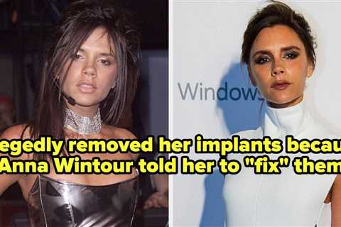 34 Celebrities Who Reversed Their Cosmetic Surgery