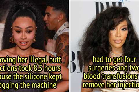 13 Celebrities Who Revealed The Shocking Consequences Of Illegal Cosmetic Procedures