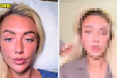 This Love Island Star Just Got Fox Eye Surgery, And The Results Are Wild
