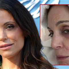 Bethenny Frankel Contracts Bacterial Infection After Partying in St. Barths