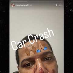 Juelz Santana Posts Facial Scrapes Selfie After Scary Car Accident