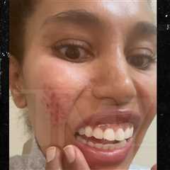 V. Stiviano Says She Blacked Out Leaving Hotel, Woke Up in Middle of Street