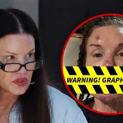 Janice Dickinson Spotted After Sharing Alleged Injuries From Reality Show Fall