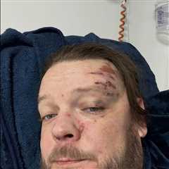 'Pawn Stars' Corey Harrison Hospitalized After Crash, Will Miss Dad's Wedding