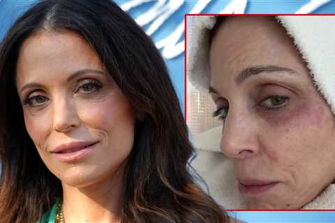 Bethenny Frankel Contracts Bacterial Infection After Partying in St. Barths