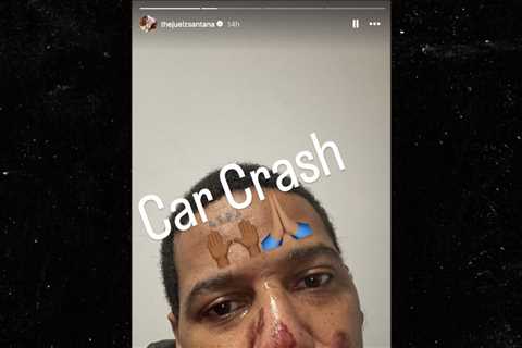 Juelz Santana Posts Facial Scrapes Selfie After Scary Car Accident