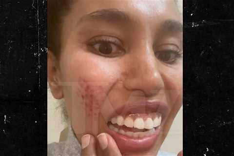 V. Stiviano Says She Blacked Out Leaving Hotel, Woke Up in Middle of Street