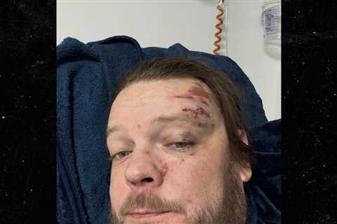 'Pawn Stars' Corey Harrison Hospitalized After Crash, Will Miss Dad's Wedding