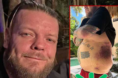 'Pawn Stars' Corey Harrison Asks Fans to Help Pay Medical Bills After Health Ordeal