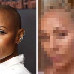 After People Accused Jada Pinkett Smith Of Lying About Having Alopecia When She Showed Off Her Hair ..