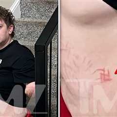 Quadruple Amputee Murder Suspect Seen With Swastika on Belly in Shocking Pic