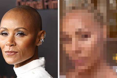 After People Accused Jada Pinkett Smith Of Lying About Having Alopecia When She Showed Off Her Hair ..