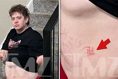 Quadruple Amputee Murder Suspect Seen With Swastika on Belly in Shocking Pic
