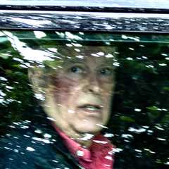 Former Prince Andrew Spotted With Massive Bruise On Face