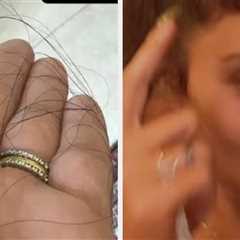 Four Months After She Revealed Her Hair Was Falling Out, Vanessa Hudgens Has Proudly Shown Off The..