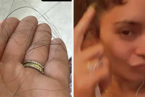 Four Months After She Revealed Her Hair Was Falling Out, Vanessa Hudgens Has Proudly Shown Off The..