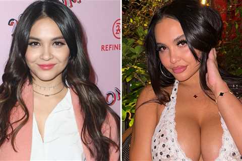 Stella Hudgens Then & Now Good Genes or Good Docs?! Hot Shots