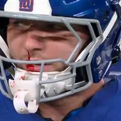 Giants’ Cam Skattebo fumes after being left bloodied by controversial facemask no-call